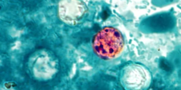 ¿Qué es la Cyclospora y cómo mitigar el riesgo?